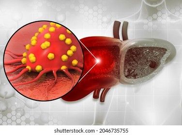 Liver Disease. Liver Infection. Viral Infection. 3d Illustration 