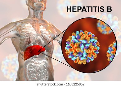 Hasil gambar untuk hepatitis b