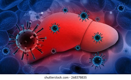 Liver Infection With Hepatitis Viruses	