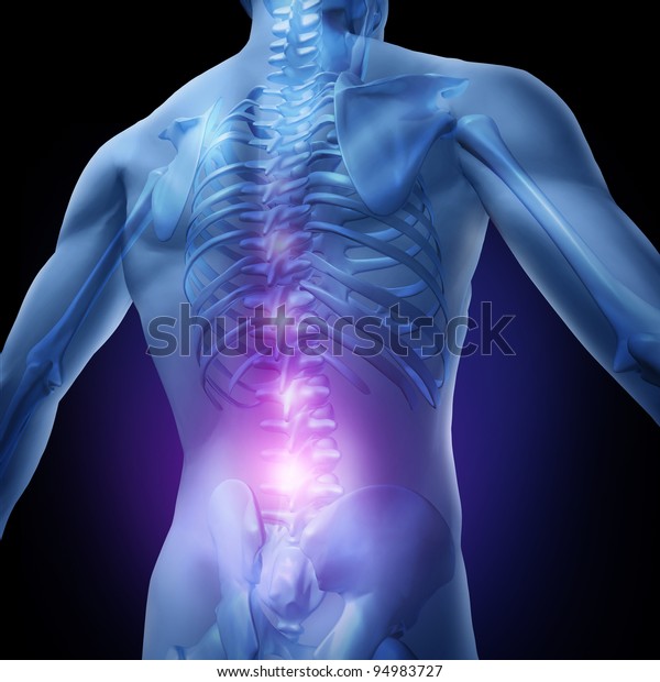Lower back pain and human backache with an upper
torso body skeleton showing the spine and vertebral column in
glowing highlight as a medical health care concept for spinal
surgery and
therapy.