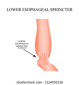 Lower Cardiac Esophageal Sphincter. Infographics. Illustration On Isolated Background