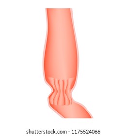 Lower Cardiac Esophageal Sphincter. Infographics. Illustration On Isolated Background