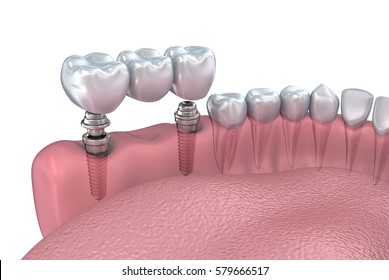 抜歯 のイラスト素材 画像 ベクター画像 Shutterstock