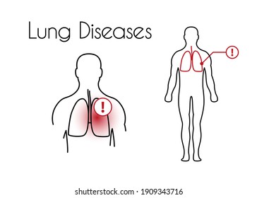 3,348 Tar lungs Images, Stock Photos & Vectors | Shutterstock