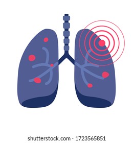 Lungs Cancer Illness Or Lung Pneumonia And Bronchitis Tuberculosis Pulmonary Disease Flat Icon Illustration, Concept Of Medicine Or Medical Respiration Infection Of Organ Sign Isolated Image