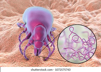 Lyme disease bacteria, Borrelia burgdorferi, transmitted by Ixodes tick, 3D illustration