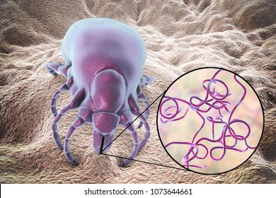 Lyme disease bacteria, Borrelia burgdorferi, transmitted by Ixodes tick, 3D illustration