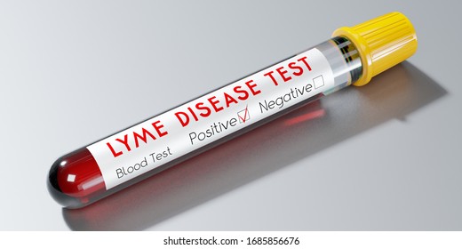 Lyme Disease Virus - Test Tube, Blood Test - 3D Illustration