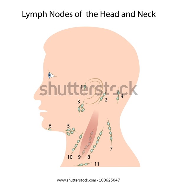 lymph node on back of head