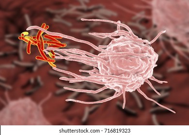 Macrophage engulfing tuberculosis bacteria Mycobacterium tuberculosis, 3D illustration