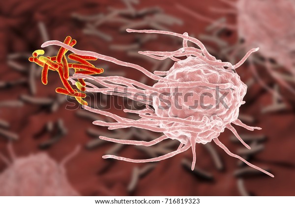 Macrophage engulfing tuberculosis bacteria\
Mycobacterium tuberculosis, 3D\
illustration