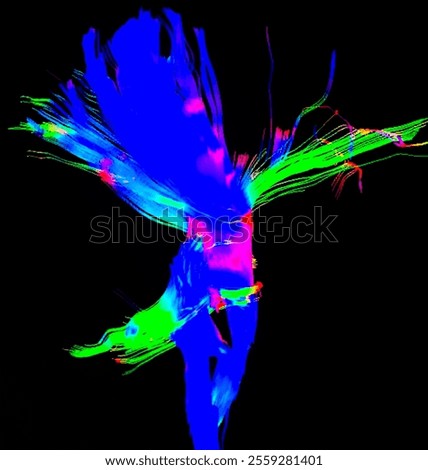 Magnetic Resonance Diffusion Tensor Imaging (MR DTI) with tractography of corticospinal tracts. Tractography of brain. 3D Illustration 