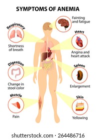 Main Sign And Symptoms That May Appear In Anemia