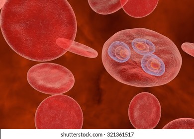 Malaria. Plasmodium Vivax In Early Trophozoite Ring Stage Inside Red Blood Cell