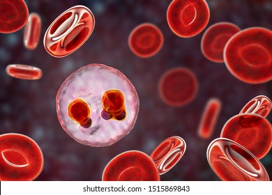 The Malaria-infected Red Blood Cells. 3D Illustration Showing Ring-form Trophozoites Of Malaria Parasite Plasmodium Falciparum Inside Red Blood Cells, The Causative Agent Of Tropical Malaria