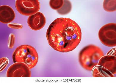 The Malaria-infected Red Blood Cells. 3D Illustration Showing Ring-form Trophozoites Of Malaria Parasite Plasmodium Falciparum Inside Red Blood Cells, The Causative Agent Of Tropical Malaria