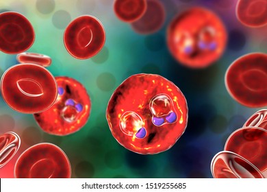 The Malaria-infected Red Blood Cells. 3D Illustration Showing Ring-form Trophozoites Of Malaria Parasite Plasmodium Falciparum Inside Red Blood Cells, The Causative Agent Of Tropical Malaria