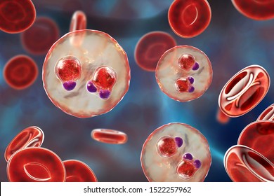 The Malaria-infected Red Blood Cells. 3D Illustration Showing Ring-form Trophozoites Of Malaria Parasite Plasmodium Falciparum Inside Red Blood Cells, The Causative Agent Of Tropical Malaria