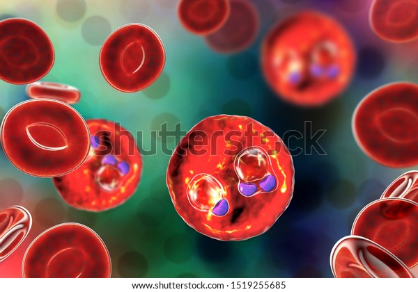 The\
malaria-infected red blood cells. 3D illustration showing ring-form\
trophozoites of malaria parasite Plasmodium falciparum inside red\
blood cells, the causative agent of tropical\
malaria