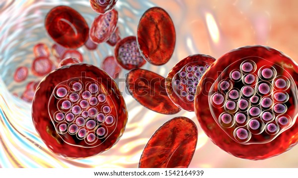 The malaria-infected\
red blood cells. 3D illustration showing parasite Plasmodium\
falciparum in schizont stage inside red blood cells, the causative\
agent of tropical\
malaria