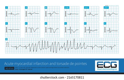 148 Qt interval Images, Stock Photos & Vectors | Shutterstock