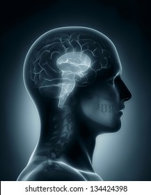 Male Brain Stem Medical X-ray Scan
