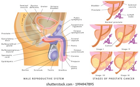 Groin Anatomy High Res Stock Images Shutterstock