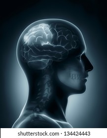 Male Parietal Lobe Medical X-ray Scan