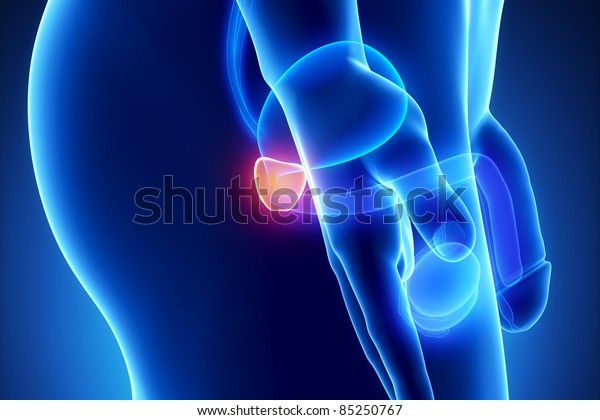 tumor de próstata uretra cofre tumor de próstata uretra cofre