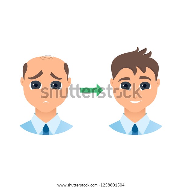 Man with alopecia before and after hair\
treatment and transplantation. Male hair loss set. Before and after\
make over series of a balding gentleman. Beauty concept design.\
Isolated\
illustration