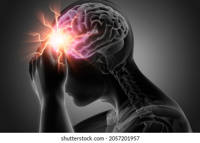 Man with heavy headache - 3D illustration