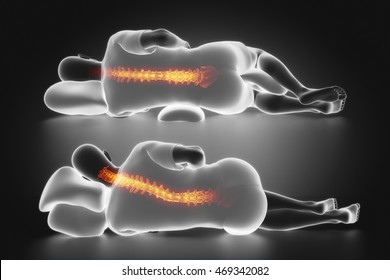 Man Sleep Posture Comparison