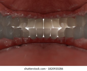 Mandibular And Maxillary Prosthesis. 3d Illustration, View From Inside Mouth.