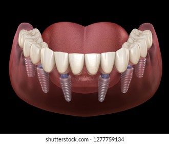 Mandibular Teeth Images, Stock Photos & Vectors | Shutterstock