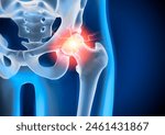 Medical 3D illustration of a painful hip joint