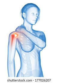 medical 3d illustration - woman having a painful shoulder