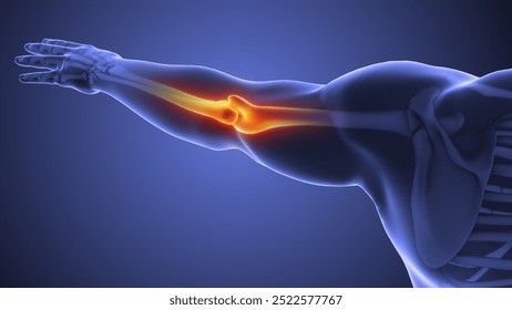 Medical disease involving elbow joint pain 3d illustration - Powered by Shutterstock