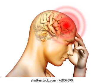 Head Pain Hd Stock Images Shutterstock