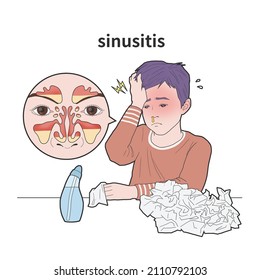 Medical Illustration Of A Child With A Headache Due To Sinusitis