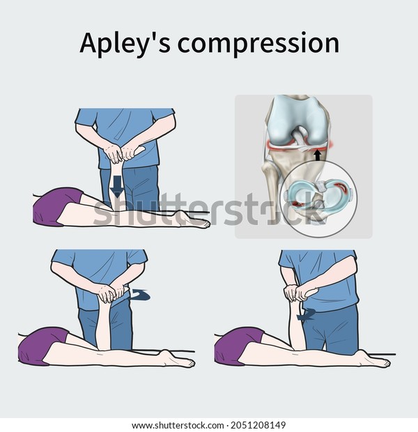 Medical Illustration Explain Apleys Compression Stock Illustration Shutterstock