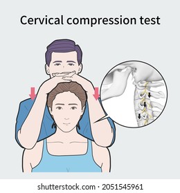 Medical Illustration To Explain Cervical Compression Test