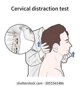 Medical Illustration To Explain 
 Cervical Distraction Test