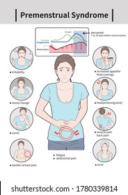 
Medical Illustration Of Premenstrual Syndrome