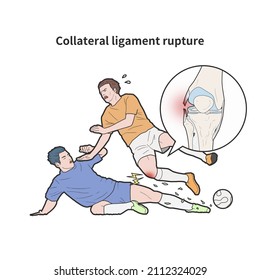 Medical Illustration Soccer Player Knee Collateral Stock Illustration ...