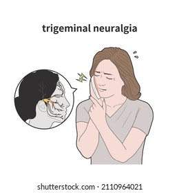 Medical illustration of a woman suffering from trigeminal neuralgia