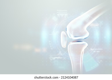 Medical Poster Image Of The Bones Of The Knee, The Joint In The Knee. Arthritis, Inflammation, Fracture, Cartilage,. Copy Space, 3D Illustration, 3D Render