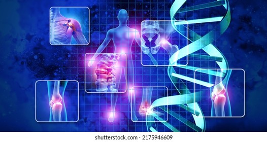 Medical Science Concept And Stem Cell Therapy Or DNA Genetic Treatment For Painful Joints And Gene Therapy With 3D Illustration Elements.