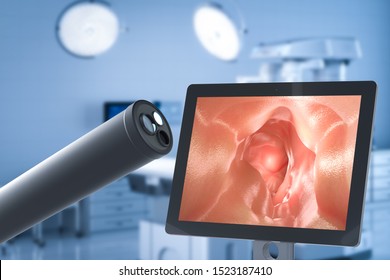 Medical technology concept with 3d rendering endoscope with monitor display intestine