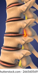 Medical Visualization of Spinal Decompression Procedure 3d illustration
