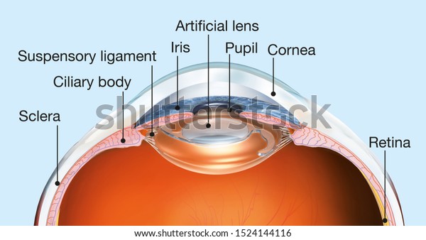 人工レンズ 瞳孔 虹彩 前室 後室 毛様体 眼球 硝子体を持つ人間の目を示す医学的3dイラスト のイラスト素材